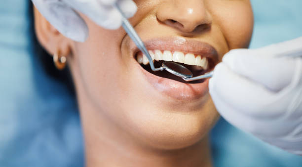 Best Emergency Treatment for Dental Infections or Abscesses in Daytona Beach Shores, FL